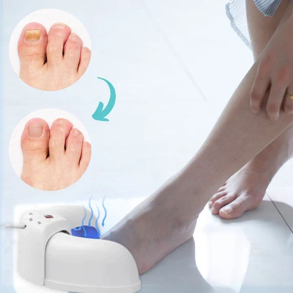 Nagelpilz Lasertherapie VitaNail