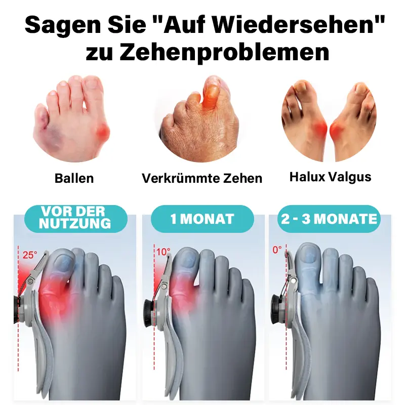 HalluxHelfer™ Ballenzeh-Korrektur