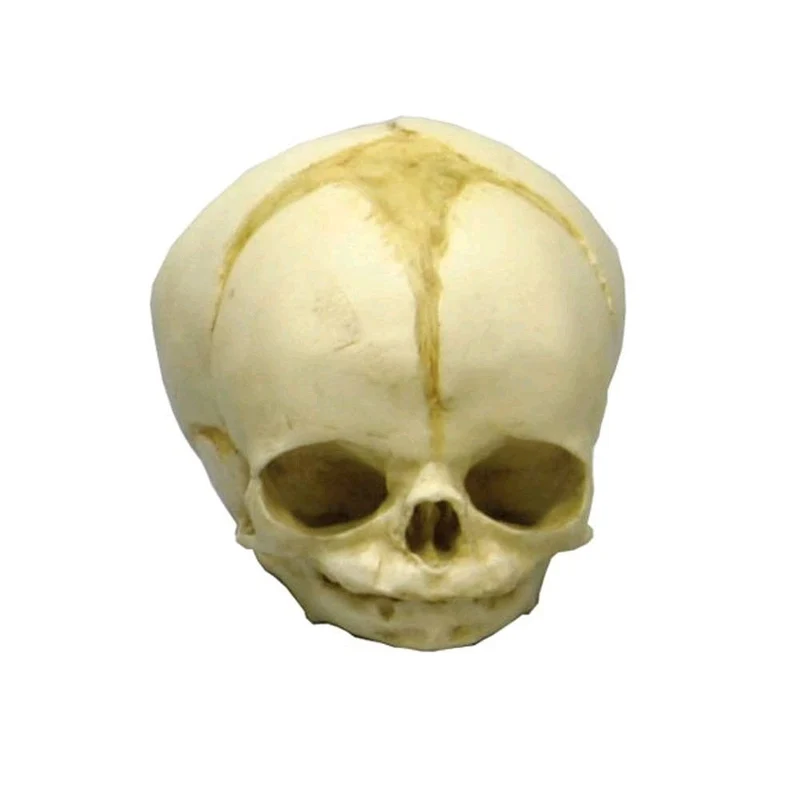 Erler Zimmer Fetusschädel Anatomie Modell, versch. Entwicklungs-Wochen