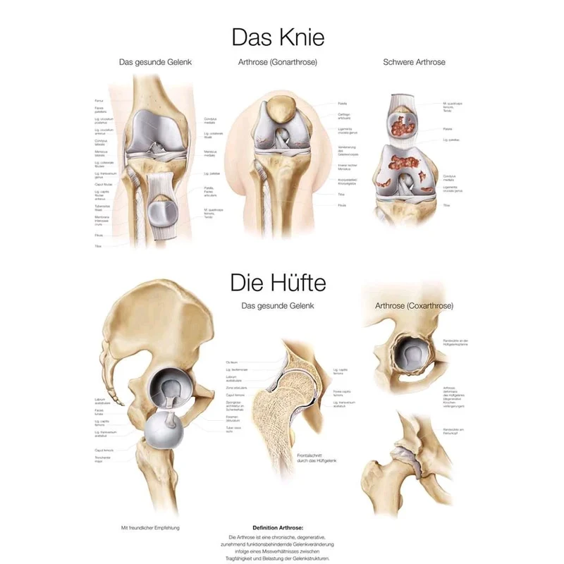 Erler Zimmer Das Knie / Die Hüfte anatomische Lehrtafel, Größenwahl