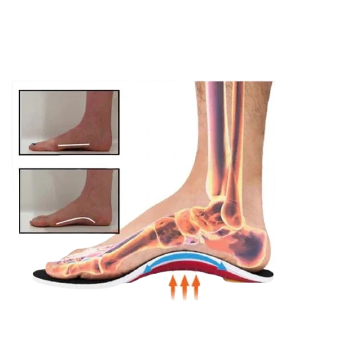 Orthopädische Schuheinlagen - Schmerzfrei durch den Tag