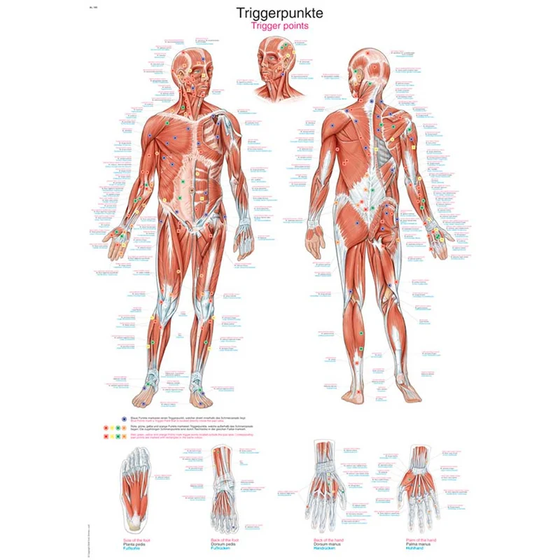 Erler Zimmer anatomische Lehrtafel - Triggerpunkte, 2 Größen
