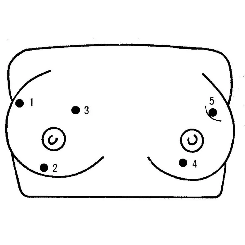 Erler Zimmer Simulator - Brustkrebs-Tastmodell, 5 Knoten