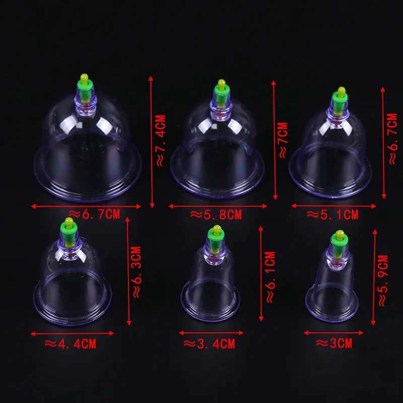 Cupping Set