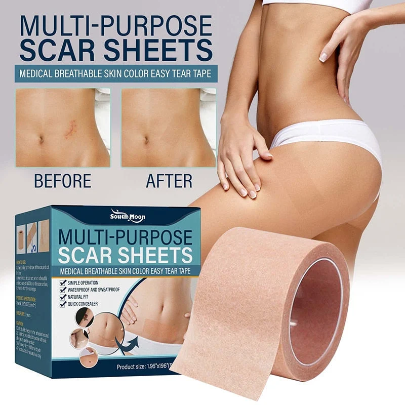 Weiches Silikon-Gel-Tape zur Narbenentfernung | Skanto
