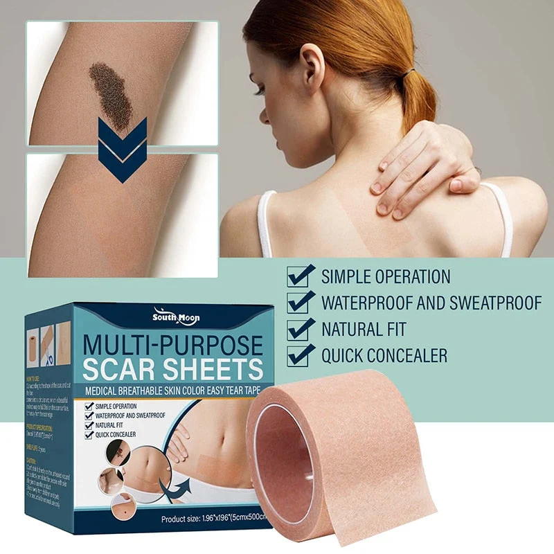 Weiches Silikon-Gel-Tape zur Narbenentfernung | Skanto