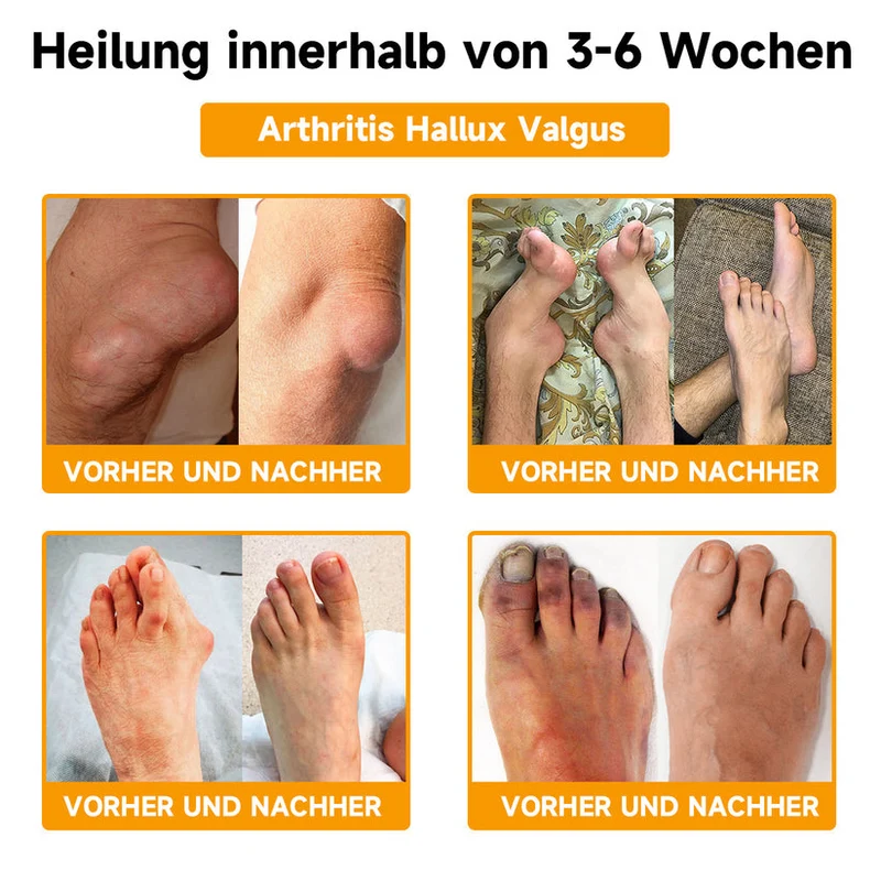 Bee Vital Creme | Schnelle Schmerzlinderung | Skanto