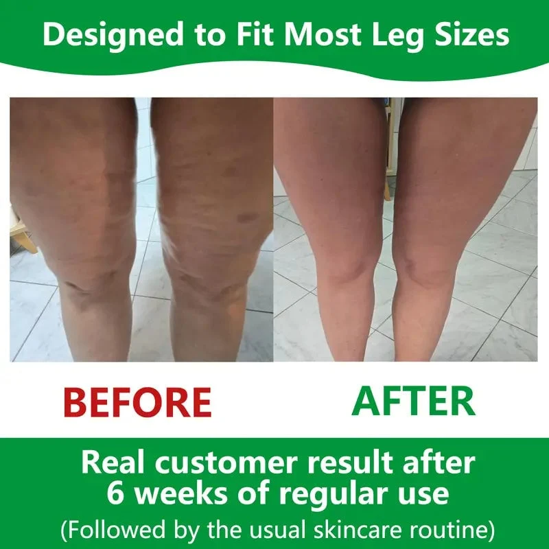 Skanto | Sakerplus Cellulite-Massageroller