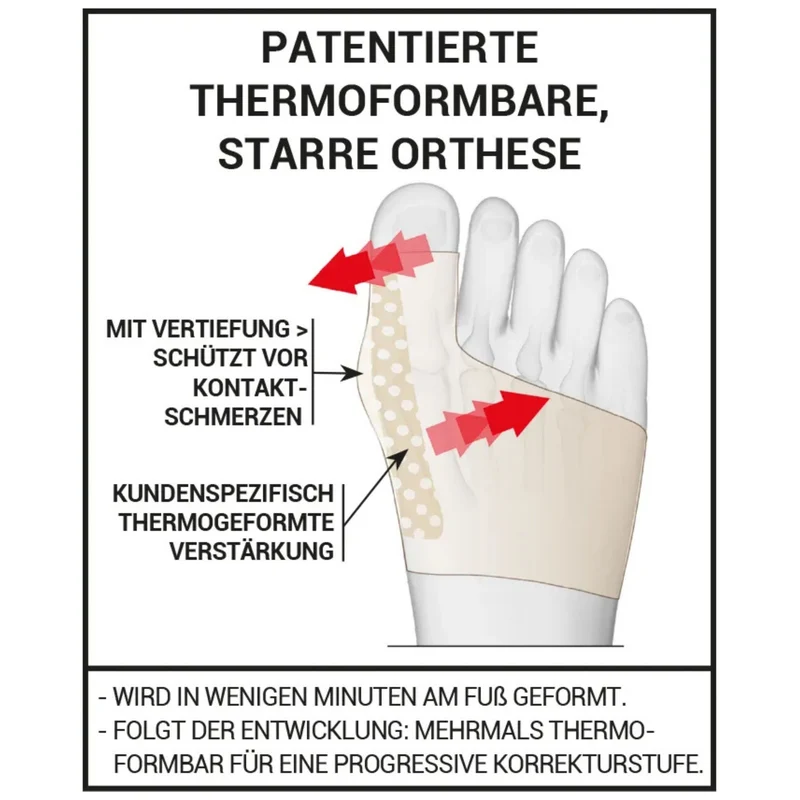 EPITACT® Hallux Valgus Korrekturbandage für die Nacht