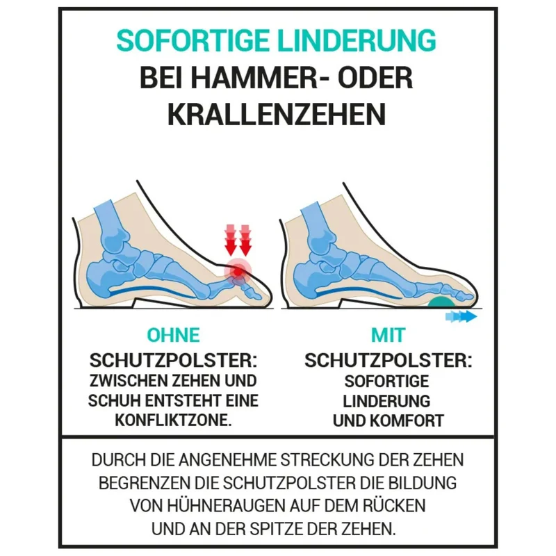 EPITACT® Zehendruckschutzpolster bei Hammer- und Krallenzehen