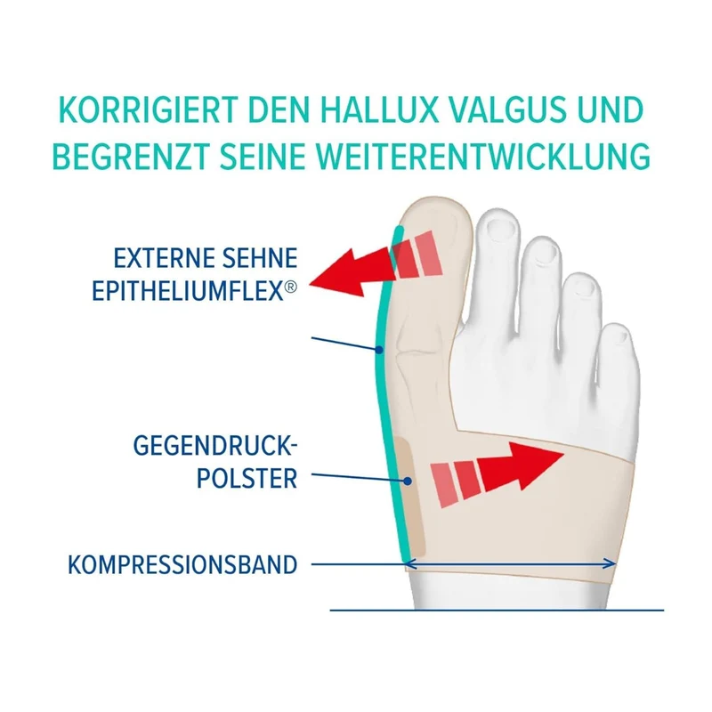 EPITACT® Flexible Korrekturbandage für den Tag