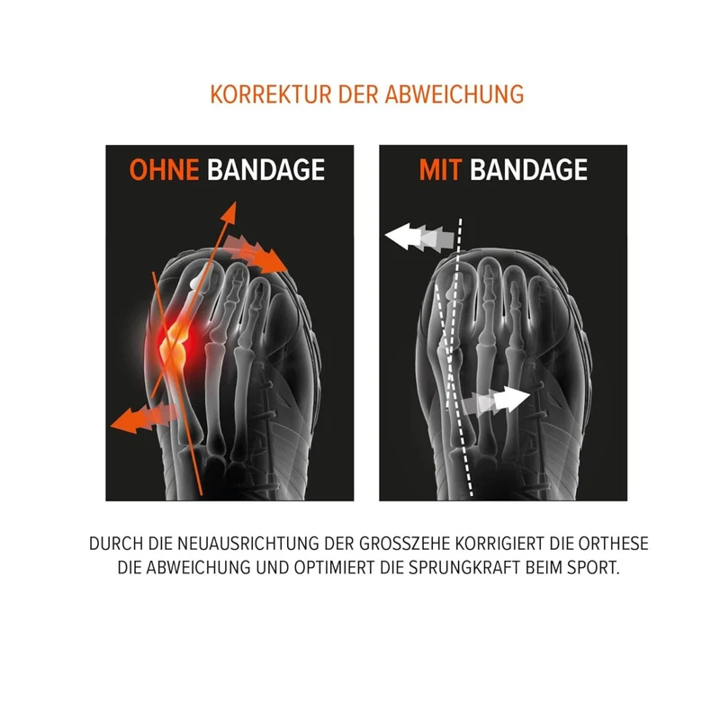 EPITACT® Hallux Valgus Korrekturbandage für den Sport