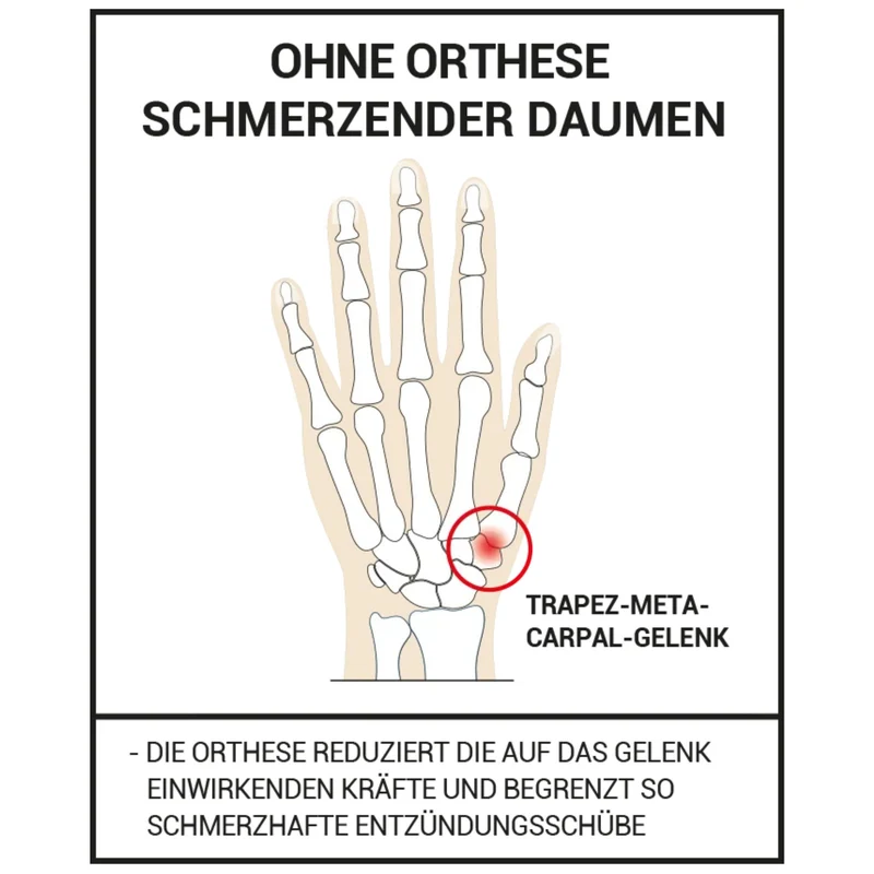 EPITACT® Ruhe-Daumenbandage Rhizarthrose