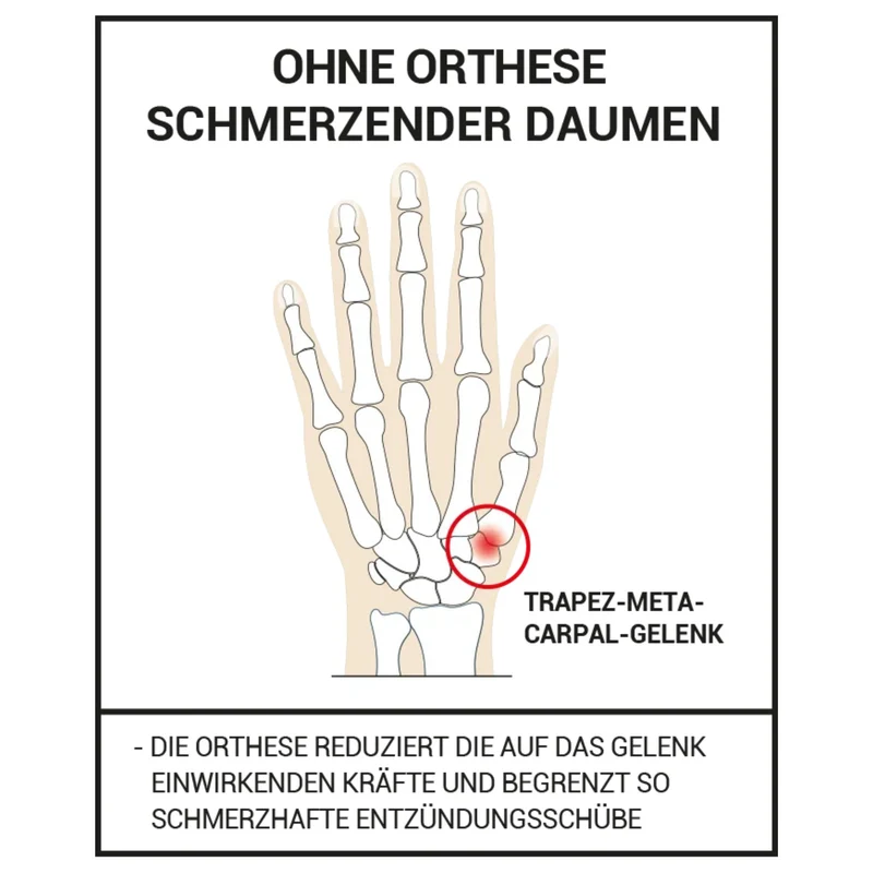 EPITACT® Flexible Aktivitäts-Daumenbandage